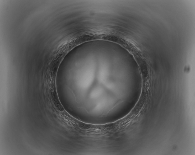 X0000091500917200708161455