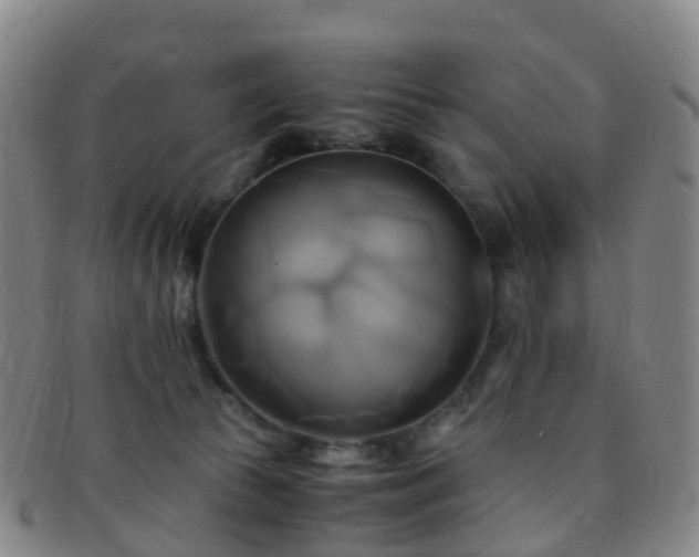 X0000091500177200708231452
