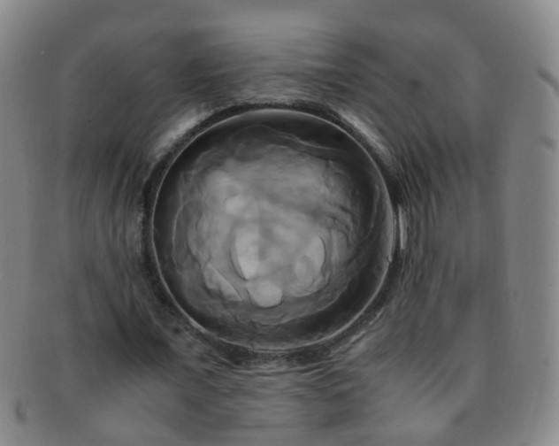 X0000091500675200708231445
