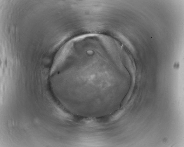 X0000091500113200709061930