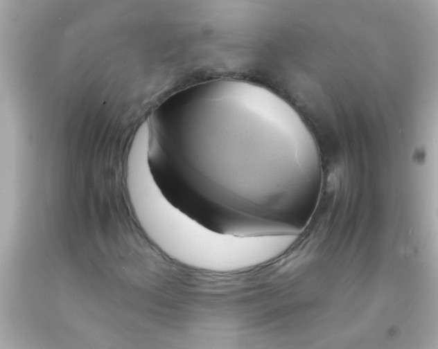 X0000091501156200709061916