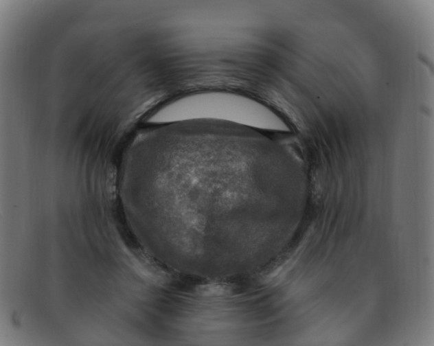 X0000091500356200709131855