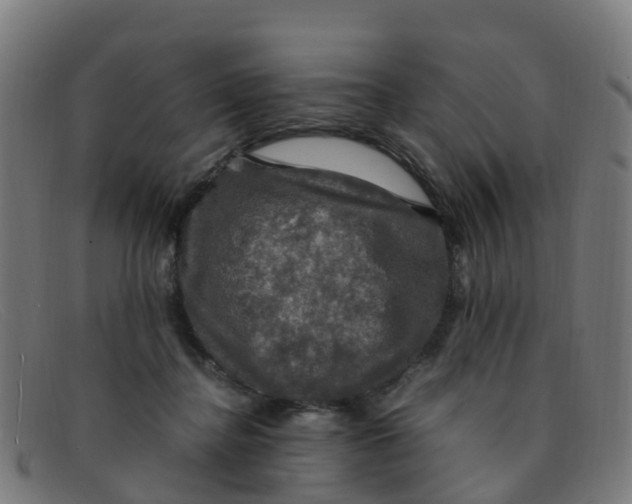 X0000091500364200709131855