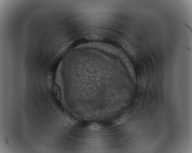 X0000091500416200709131854