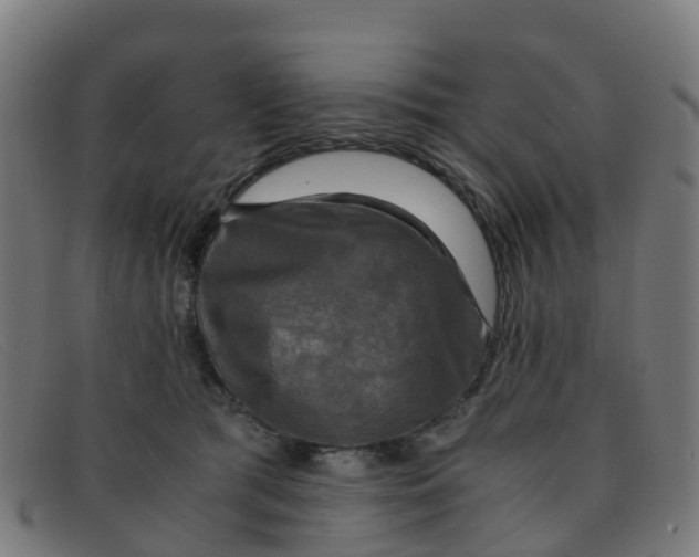 X0000091500417200709131854