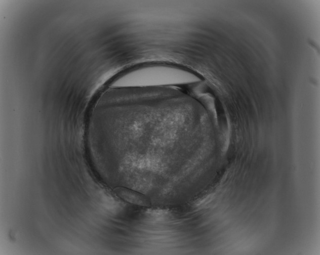 X0000091500440200709131853