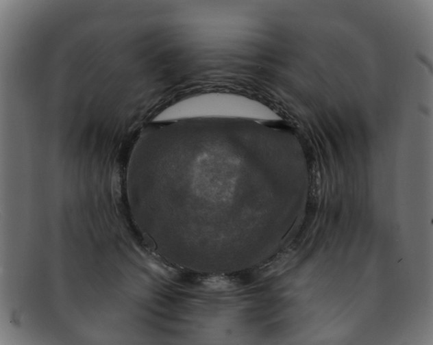 X0000091500562200709131853