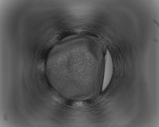 X0000091500611200709131852