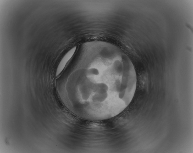 X0000091500657200709131851