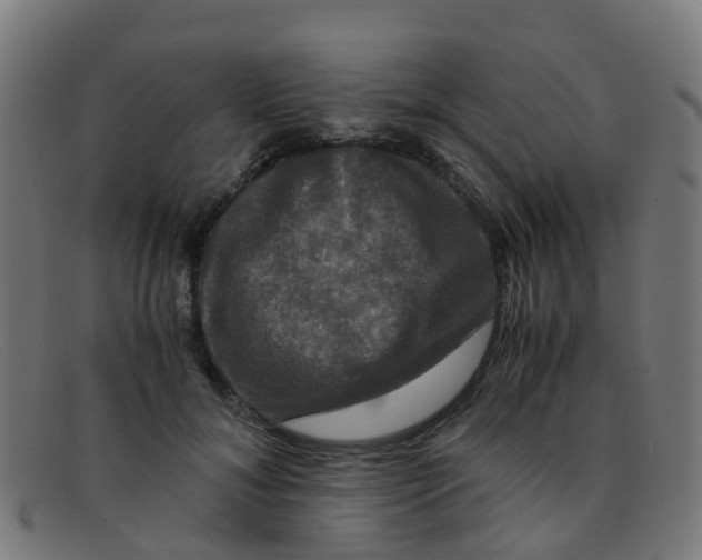 X0000091500700200709131851