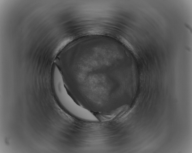 X0000091500930200709131847