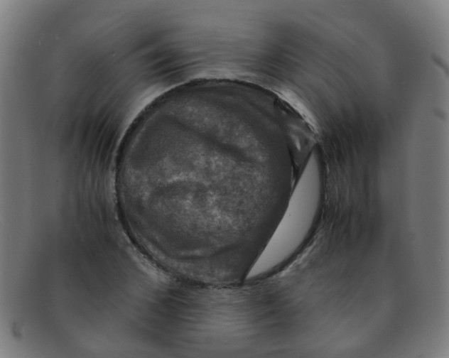 X0000091500976200709131847