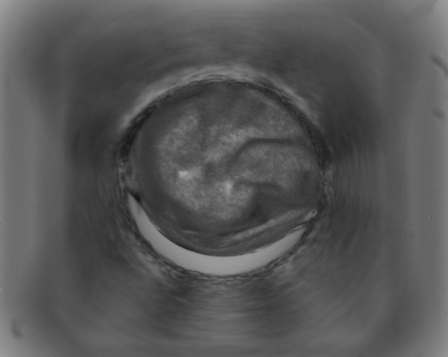 X0000091501496200709131840