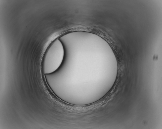 X0000091510006200708170958