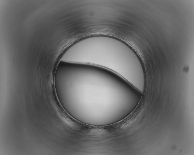 X0000091510397200708170953