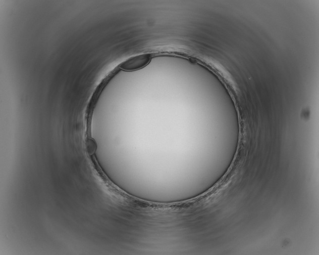 X0000091511031200708170945