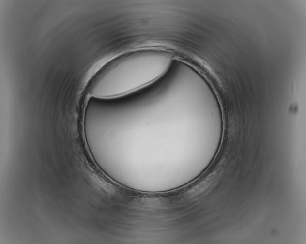 X0000091511066200708170945