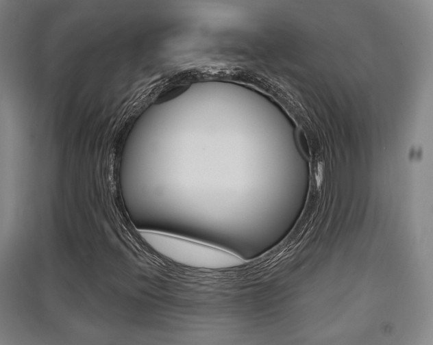 X0000091511396200708170940