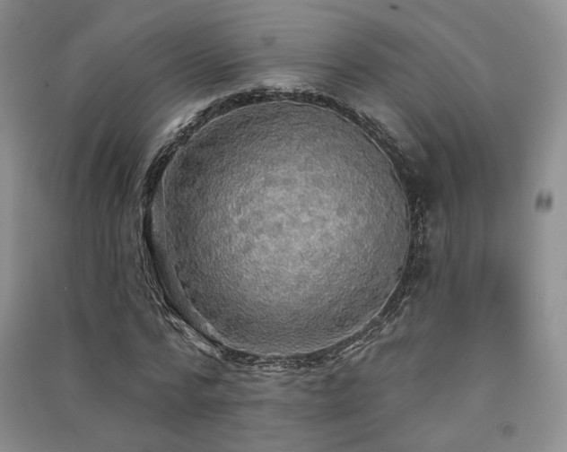 X0000091510776200708171155