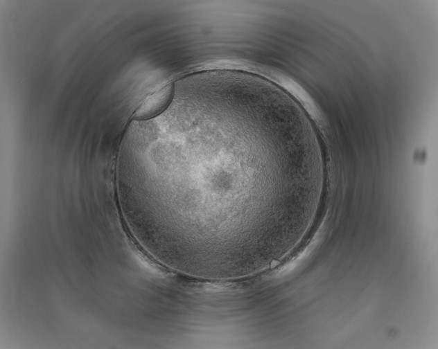X0000091510857200708171154