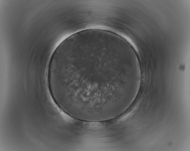 X0000091511007200708171152