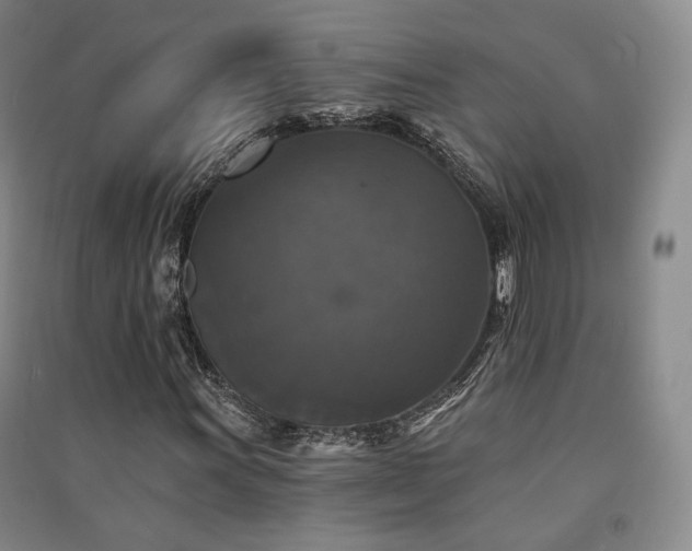 X0000091511011200708171151