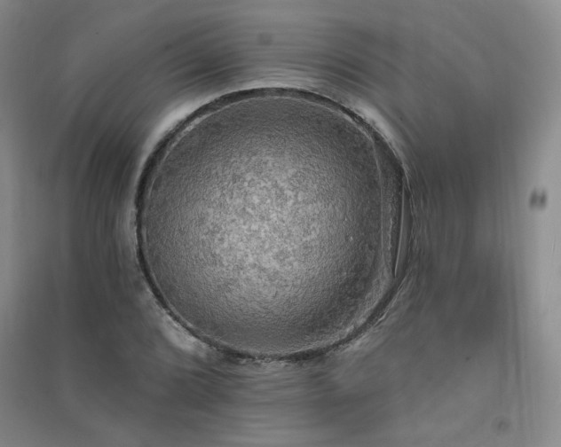 X0000091511072200708171151