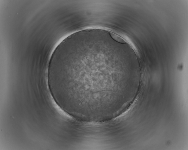X0000091511100200708171151