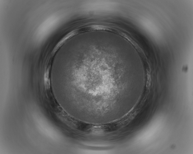 X0000091511198200708171149