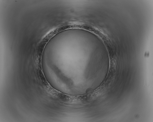X0000091511254200708171148