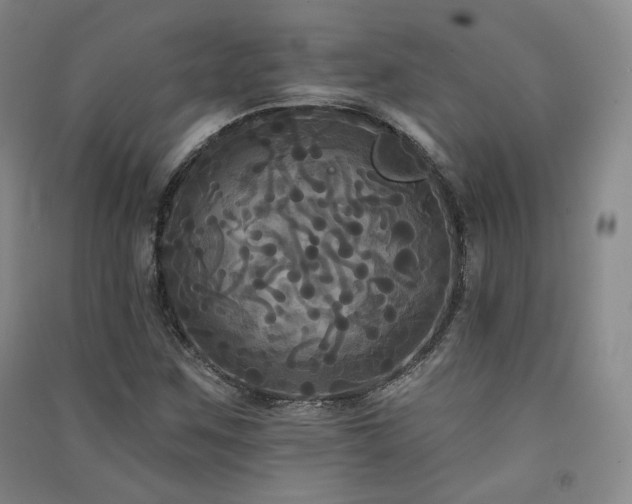 X0000091511259200708171148