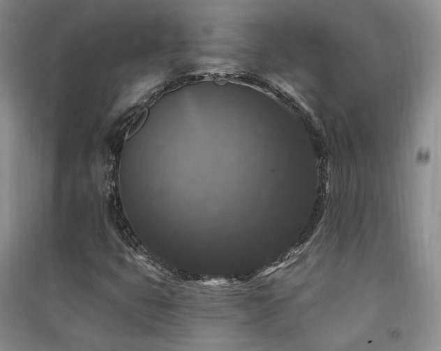 X0000091511399200708171146