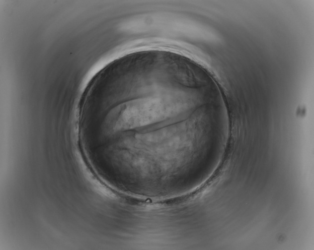 X0000091511522200708171145