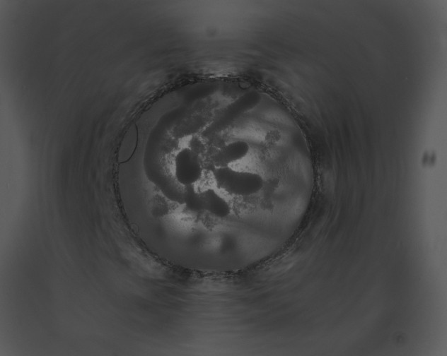 X0000091511393200708311217