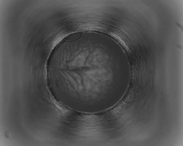 X0000091511031200709070948