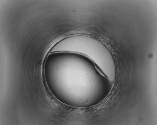 X0000091520148200708171017