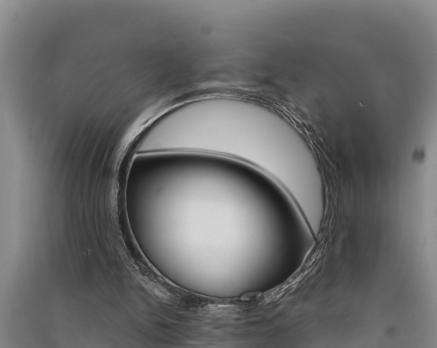 X0000091520150200708171017