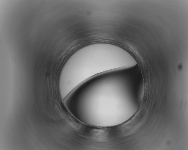 X0000091520170200708171017