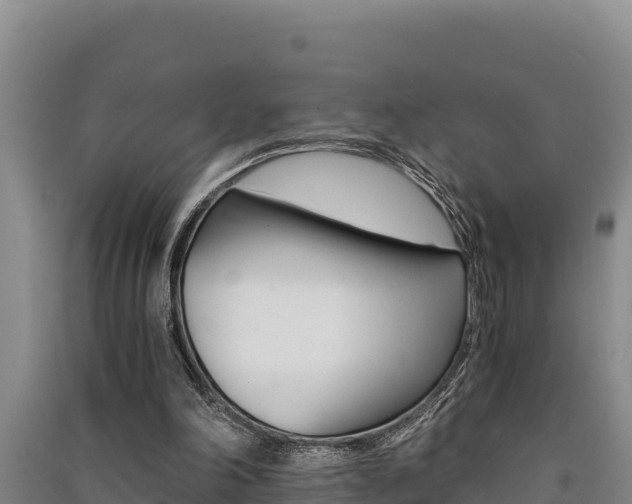X0000091520198200708171017