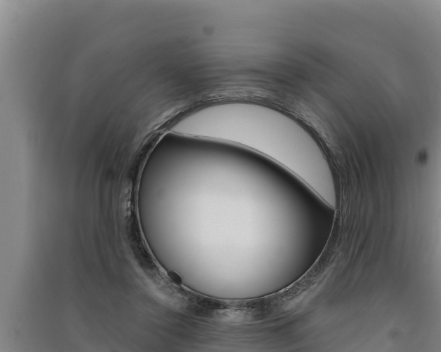 X0000091520356200708171015