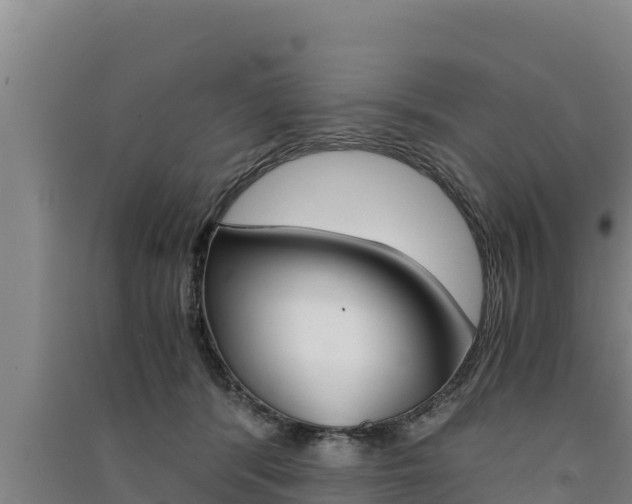 X0000091520416200708171014