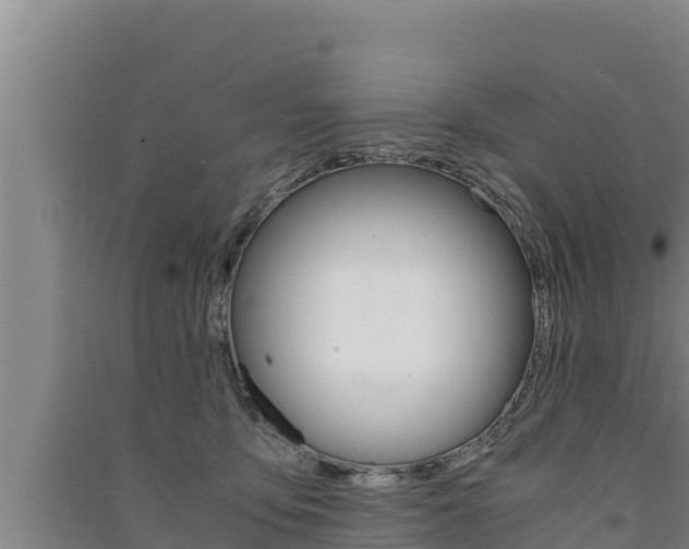 X0000091520419200708171014