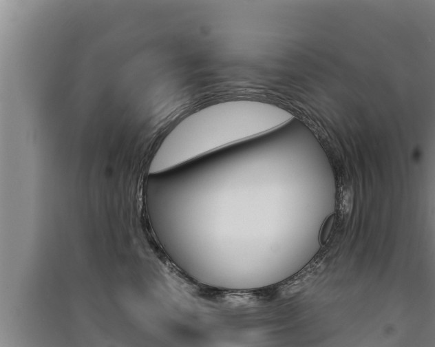 X0000091520666200708171011