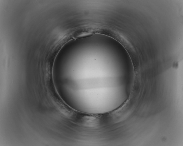 X0000091520170200708171223
