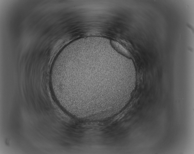 X0000091520049200709071027