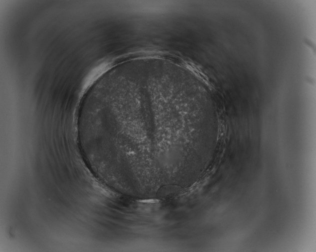 X0000091520053200709071027