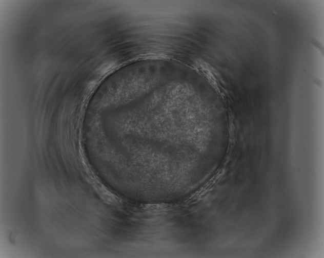 X0000091520145200709071025