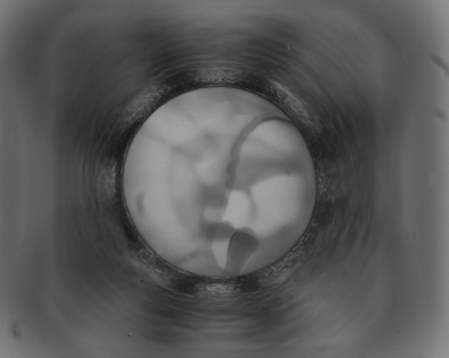 X0000091520163200709071025