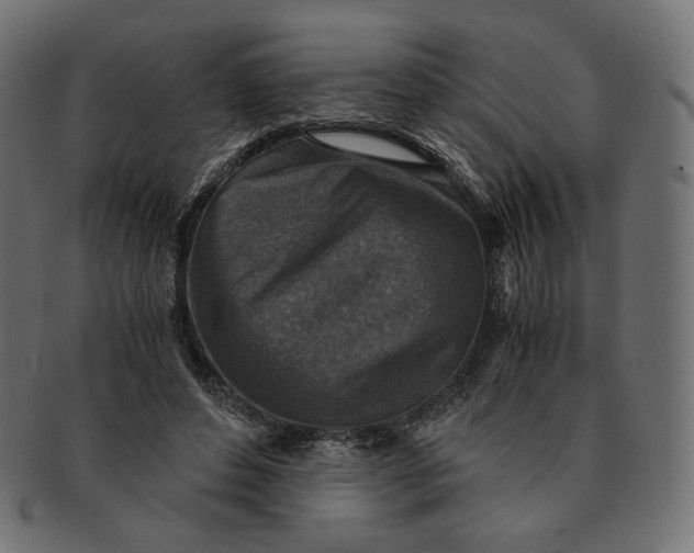 X0000091520496200709071020