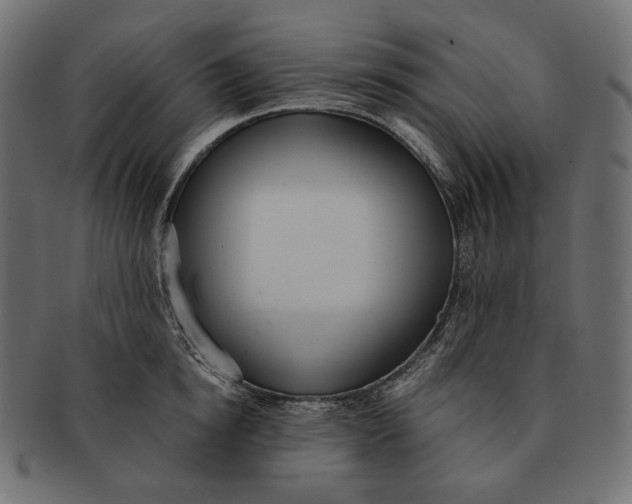 X0000091520854200709071015